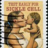 Sickle Cell Pic 2
